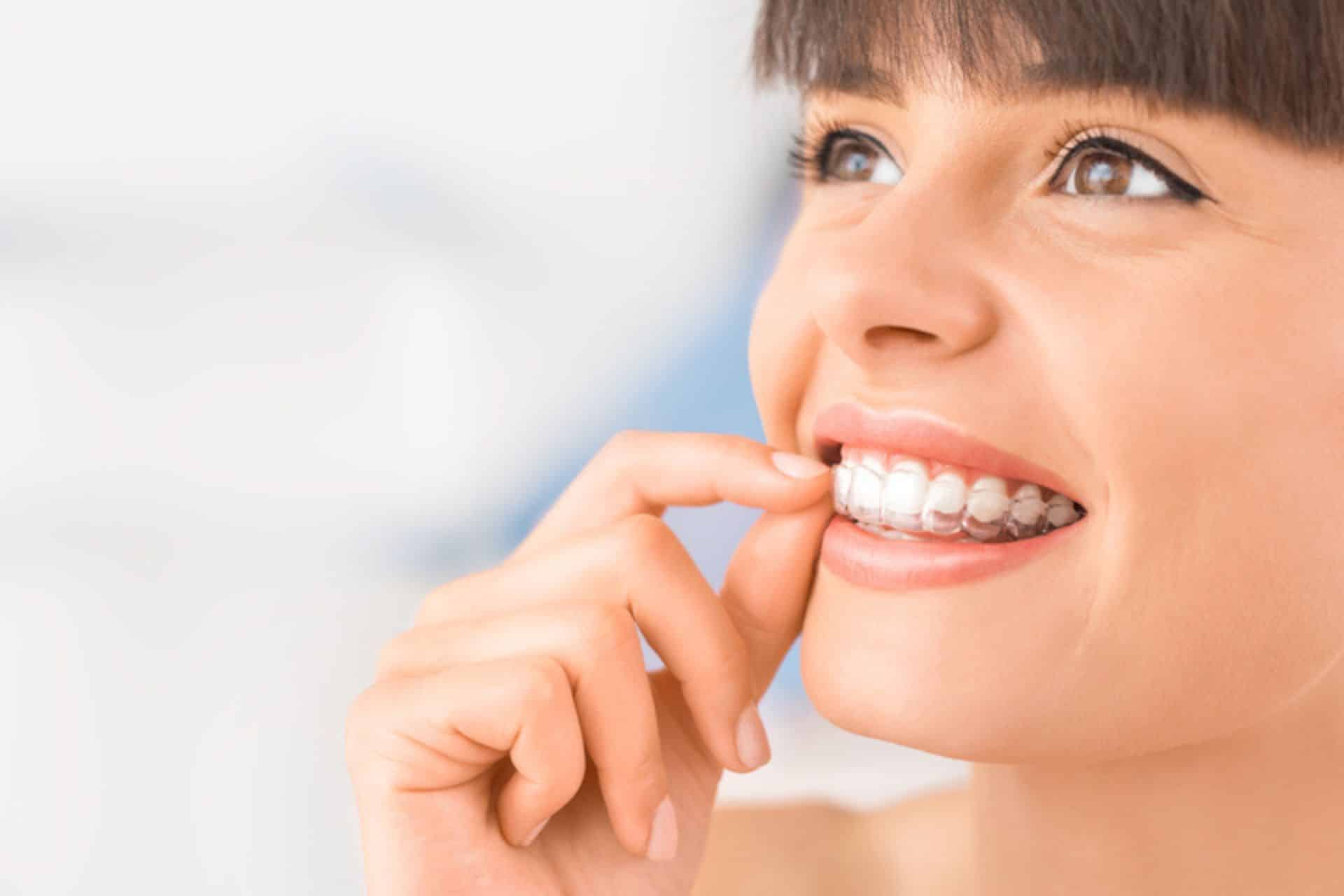 What to Expect When Talking With Invisalign or Braces? Moss Wall Orthodontics in Lacey, WA