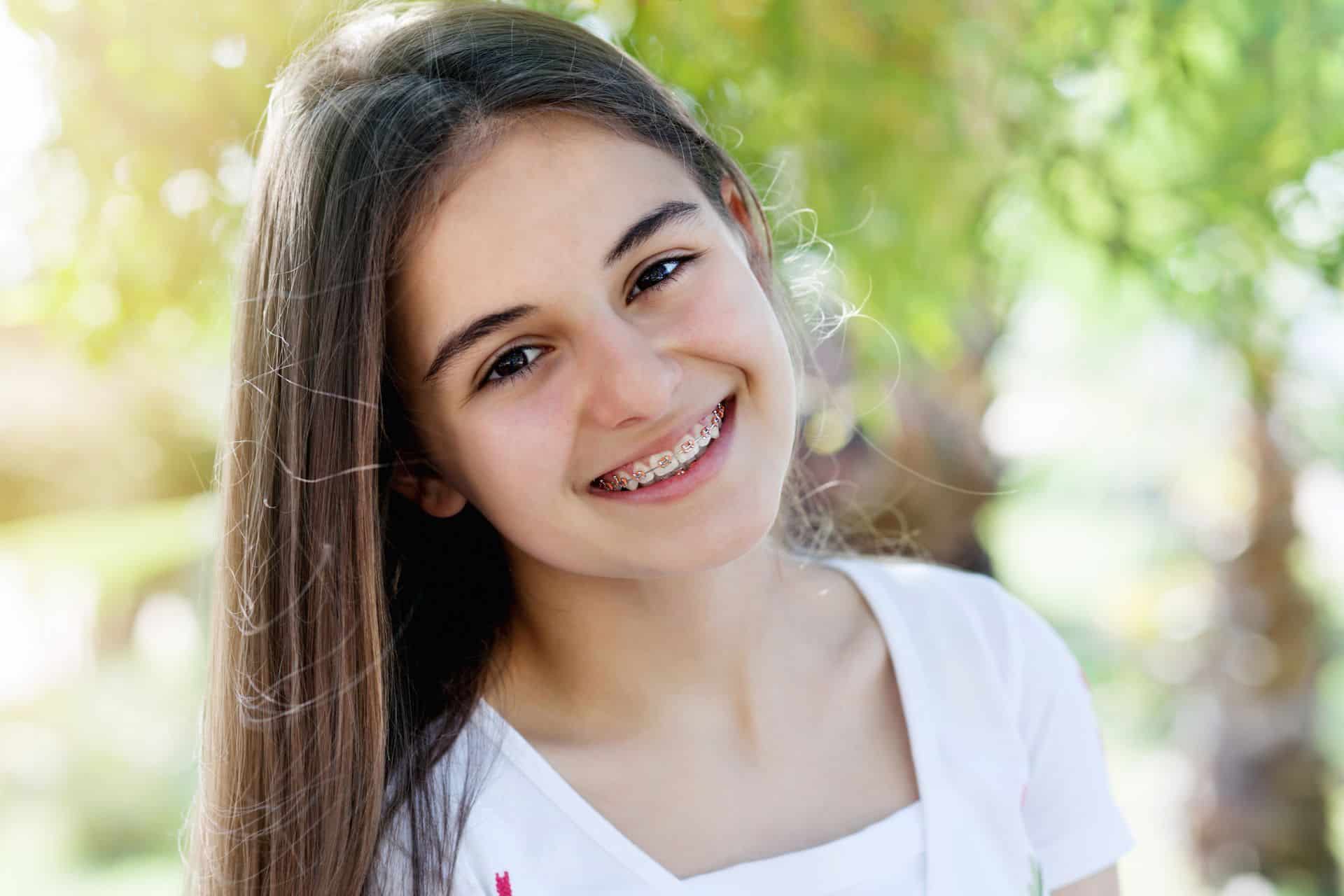 Can Braces Change the Shape of Your Face? Moss Wall Orthodontics in Lacey, WA